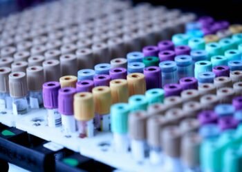 Testalize me 0je8ynv4mis unsplash 1024x683.jpg